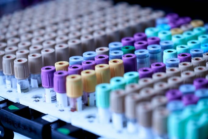 sample-management-in0-biopharmaceutical-research-best-practices-and-digital-digital-tools-for-optimization