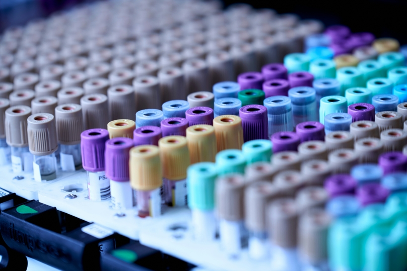 sample-management-in0-biopharmaceutical-research-best-practices-and-digital-digital-tools-for-optimization