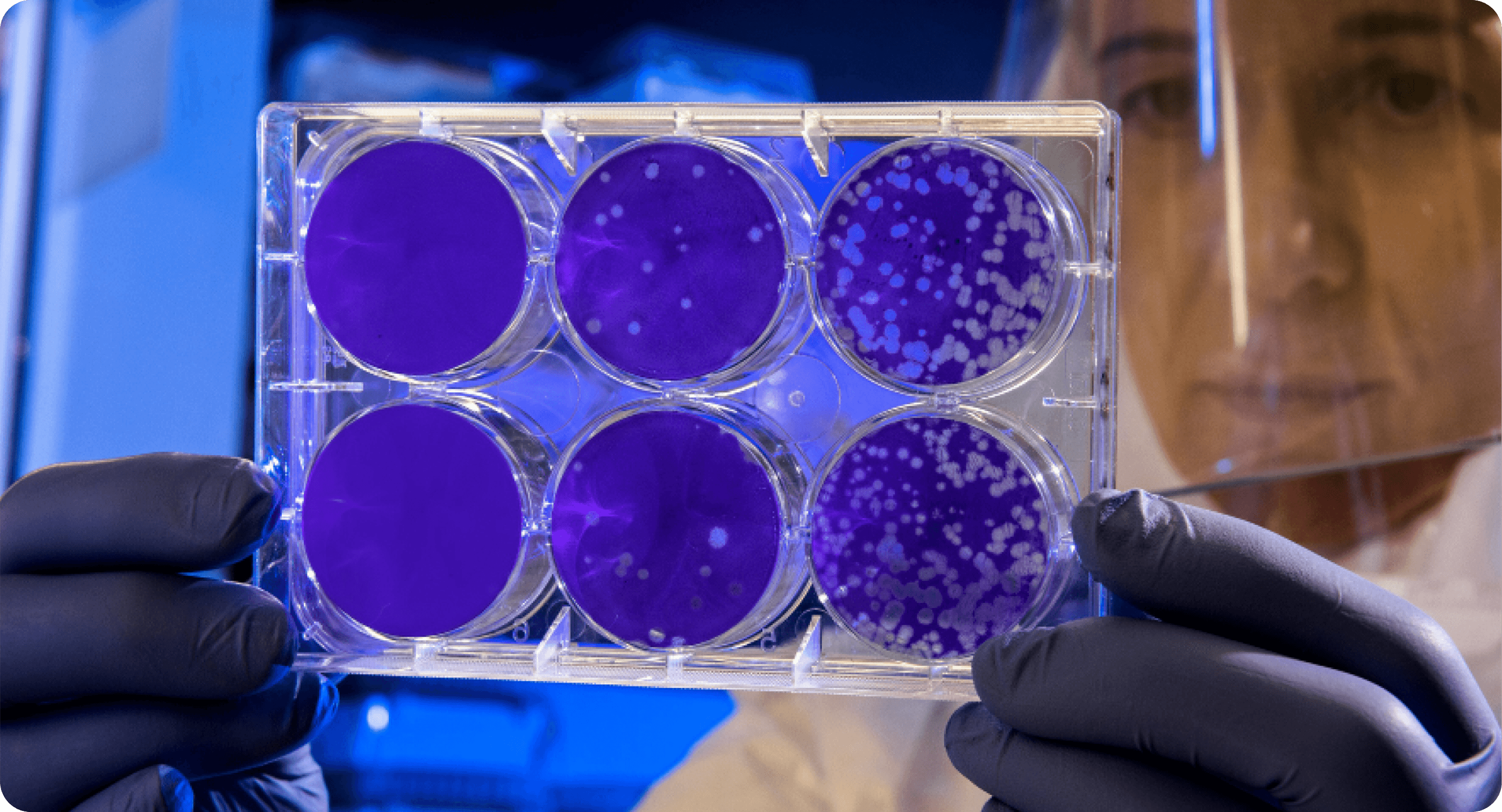 Wisconsin-State-Lab-of-Hygiene-Case-Study