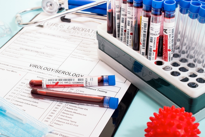 best-lab-management-software-biotech-startups-2026